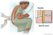 Evaluating the reliability of anatomic landmarks in safe lumbar puncture using magnetic resonance imaging: does sex matter?